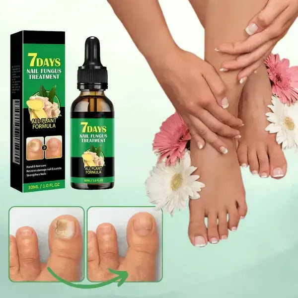 SPRAY ANTIMICÓTICO PARA UÑAS - TRATAMIENTO ANTIMICÓTICO 7 DÍAS 100% NATURAL